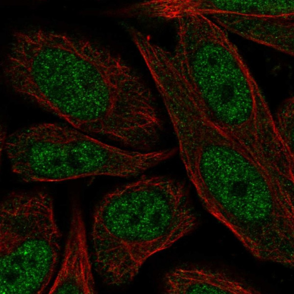 Anti-ERCC2