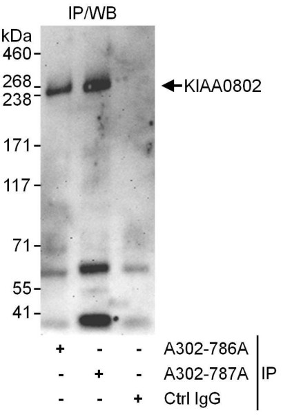 Anti-KIAA0802