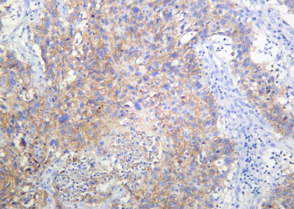 Anti-Recombinant RSK3, clone 2D5