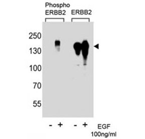 Anti-phospho-ErbB2 (Tyr1222)