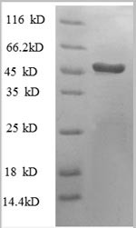 Heterogeneous nuclear ribonucleoprotein H (HNRNPH1), partial, human, recombinant