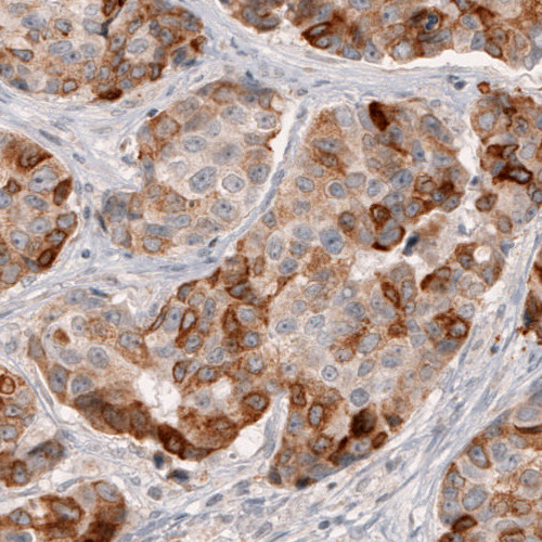 Anti-HMGCR, clone CL0260