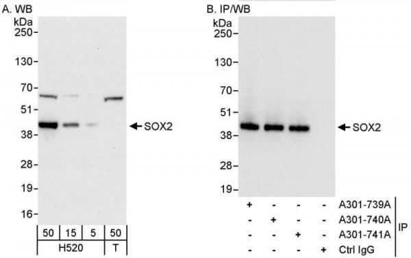Anti-SOX2