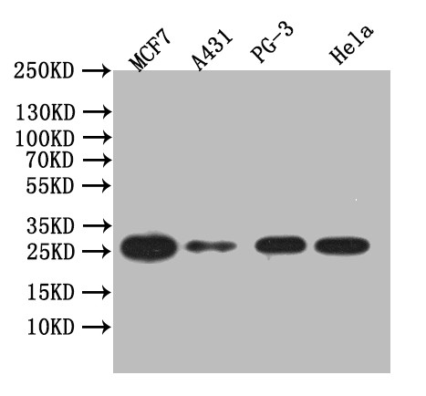 Anti-LGALS3, recombinant clone 5E5