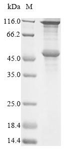 Melanoma-associated antigen 2 (MAGEA2), human, recombinant