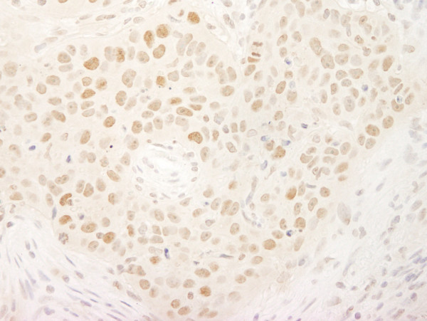 Anti-KIFC1