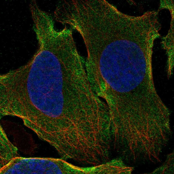 Anti-GPATCH1