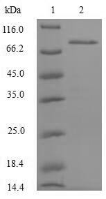 NF-kappa-B-repressing factor (NKRF), partial, human, recombinant