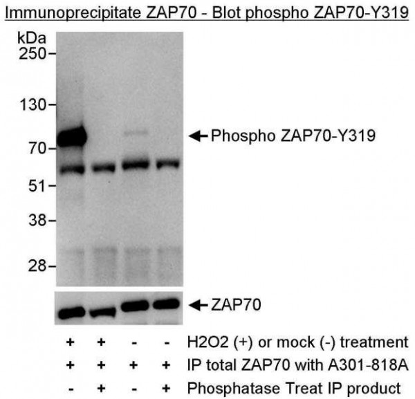 Anti-phospho-ZAP70 (Tyr319)