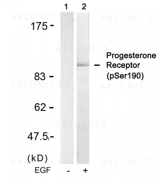 Anti-phospho-Progesterone Receptor (Ser190)