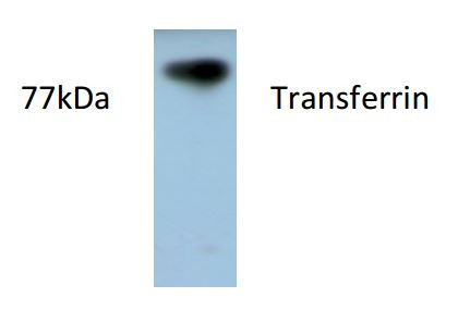 Anti-Transferrin