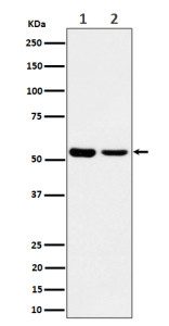 Anti-AAMP / Angio associated migratory cell protein, clone 29A85