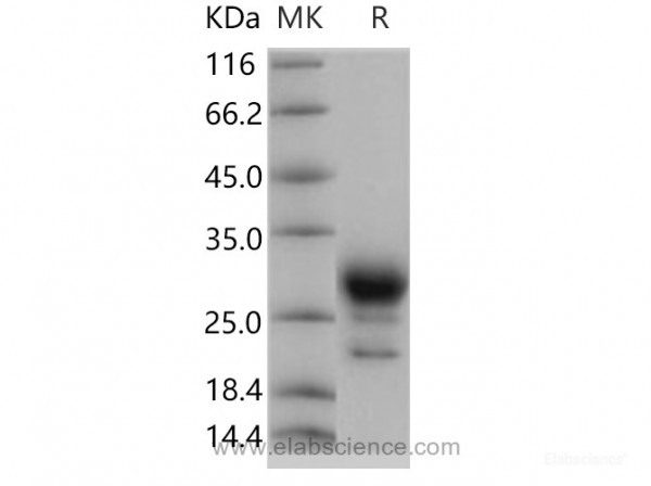 Prostaglandin D Synthase Protein (His Tag) (recombinant human)