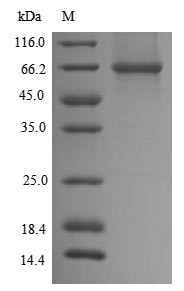 Dihydrolipoyllysine-residue acetyltransferase component of pyruvate dehydrogenase complex, mitochond