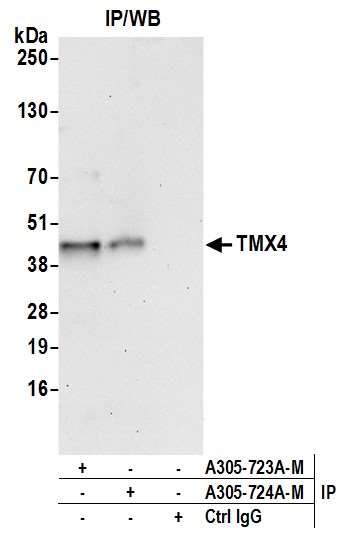Anti-TMX4