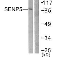 Anti-SENP5