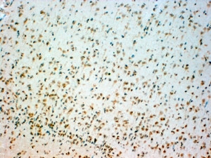 Anti-Tryptophan hydroxylase 2 / TPH2, Internal