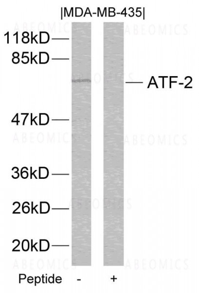 Anti-ATF2 (Ab-112 or 94)