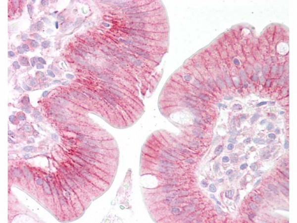 Anti-beta Catenin