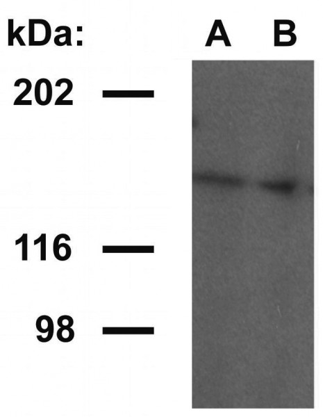 Anti-Ubinuclein 1, clone UBN1-02