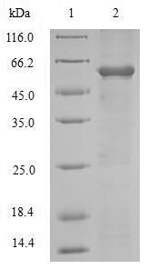Disintegrin and metalloproteinase domain-containing protein 12 (Adam12), partial, mouse, recombinant