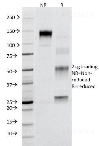 Anti-CD95 / FAS / TNFRSF6 Monoclonal Antibody (Clone: B-R18)