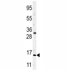 Anti-Histone H3