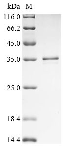 Ras-related protein Rab-12 (RAB12), human, recombinant