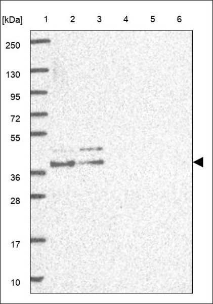 Anti-WNT5A