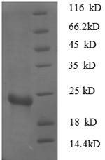 30S ribosomal protein S7 (rpsG), Escherichia coli, recombinant