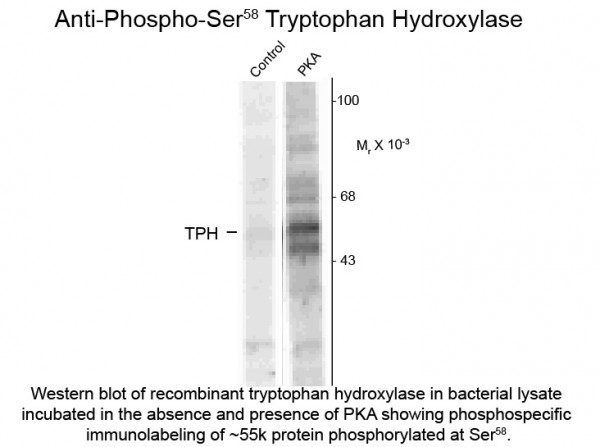 Anti-phospho-Tryptophan Hydroxylase (Ser58)