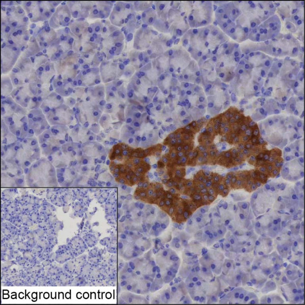 Anti-GAD2