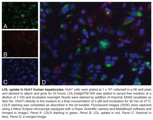 LDL Uptake Cell-Based Assay Kit