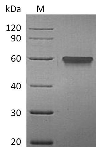 Tumor necrosis factor receptor superfamily member 9 (TNFRSF9), partial (Active), human, recombinant