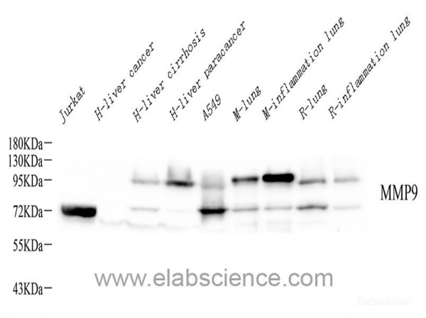 Anti-MMP9, clone 7C3A2