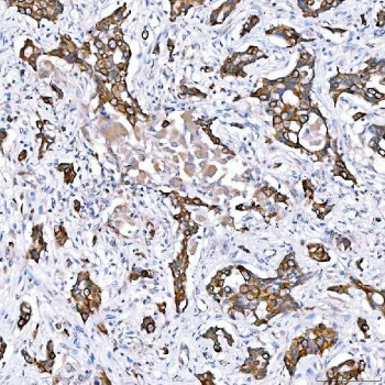 Anti-Cytokeratin 4 / KRT4
