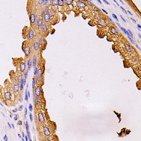 Anti-EDIL3