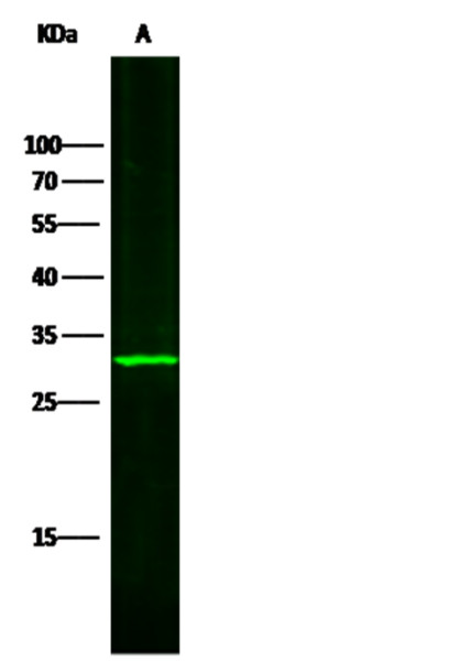 Anti-SULT1A1 Monoclonal Antibody
