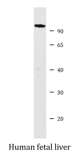 Anti-CEP85L