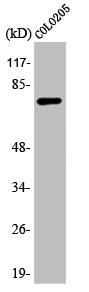 Anti-ATF6B