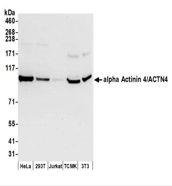 Anti-alpha Actinin 4/ACTN4