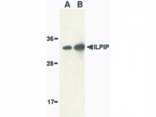 Anti-ILPIP