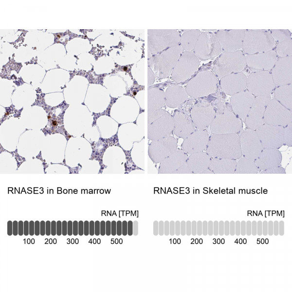 Anti-RNASE3