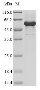 Nuclear receptor ROR-alpha (RORA), human, recombinant
