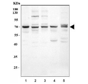 Anti-GRK5