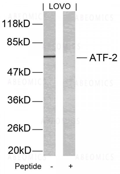 Anti-ATF2 (Ab-69 or 51)