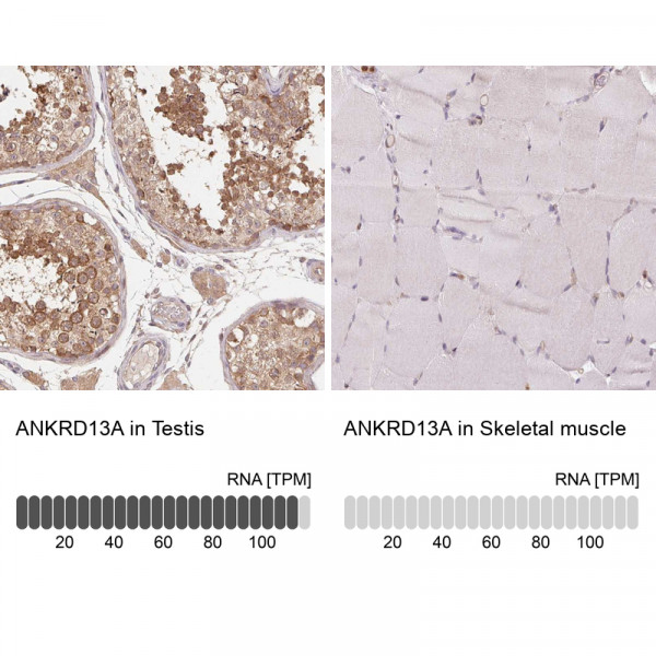 Anti-ANKRD13A
