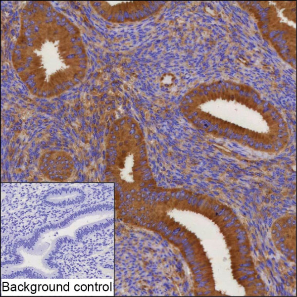 Anti-DCTN2