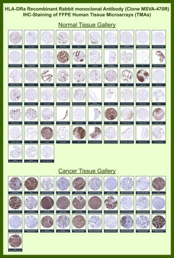 Anti-HLA-DRA / Major histocompatibility complex class II DR alpha chain, clone MSVA-470R