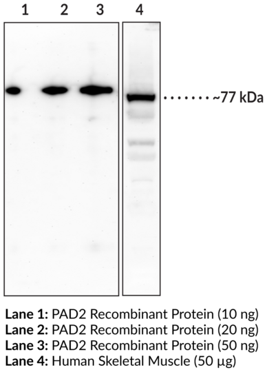 Anti-PAD2